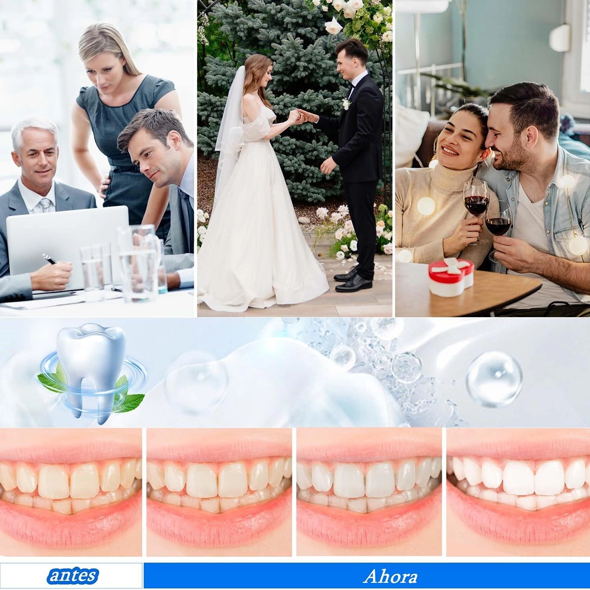 نوار سفید کننده دندان 5D white